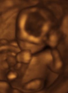 Baby in the womb at 17 weeks sucking his thumb and waving 